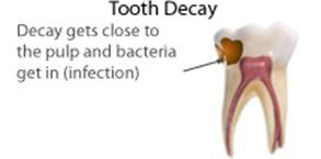 Pulp treatment diagram